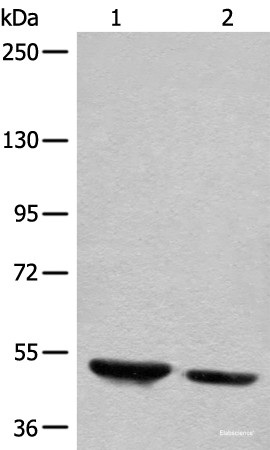 Anti-DENND1B