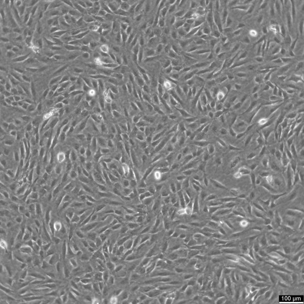 SJSA-1 Cells