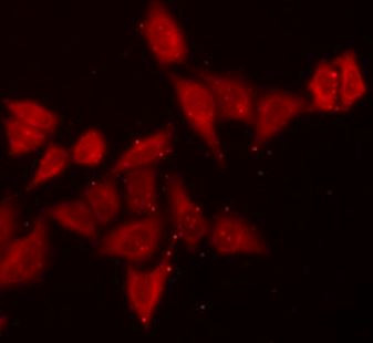Anti-BNIP2