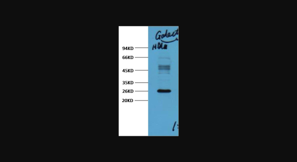 Anti-Galectin-3, monoclonal