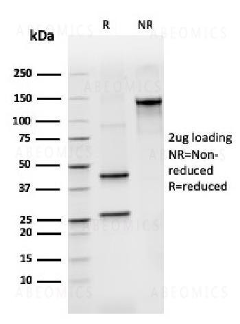 Anti-BCL2-like 2 Monoclonal Antibody (Clone: CPTC-BCL2L2-2)
