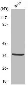 Anti-Cleaved-CTSV (L114)