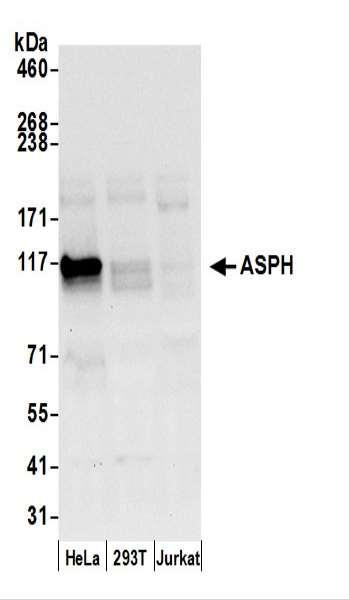 Anti-ASPH