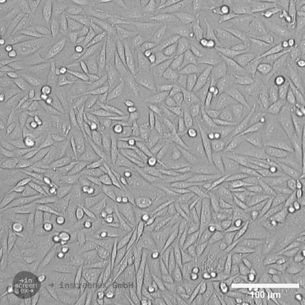 CHO-HER2 Cells
