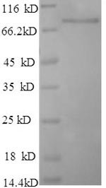 Poly (A)-specific ribonuclease PARN (PARN), human, recombinant