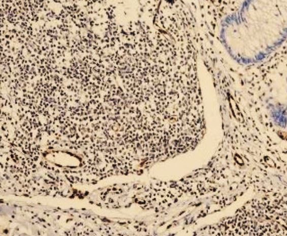 Anti-ERG, clone SQab20203