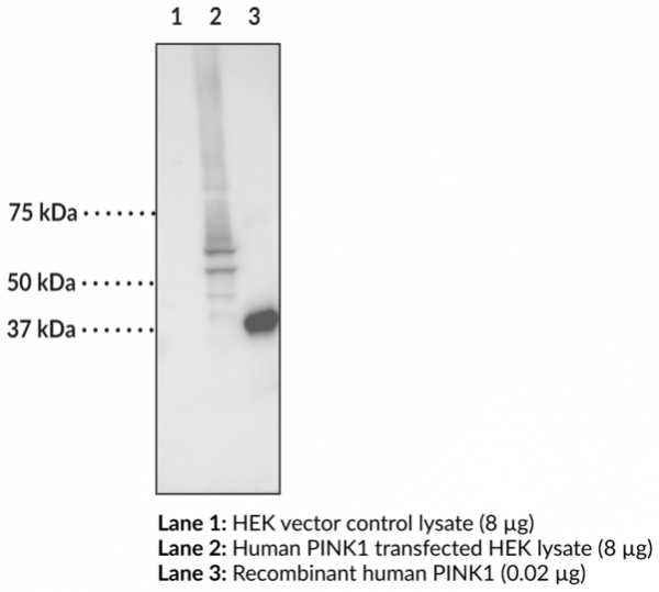 Anti-PINK1 Monoclonal Antibody (Clone 3E8)