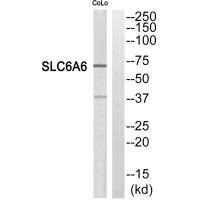 Anti-SLC6A6