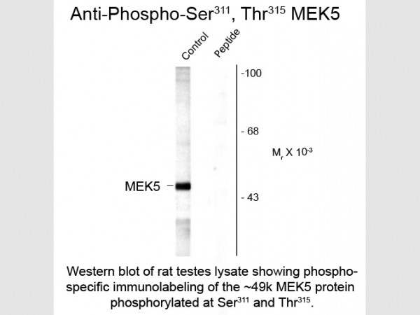 Anti-phospho-MEK5 (Ser311/Thr315)