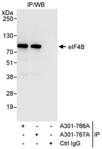 Anti-eIF4B