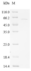 Sarcoplasmic/endoplasmic reticulum calcium ATPase 2 (ATP2A2), partial, human, recombinant