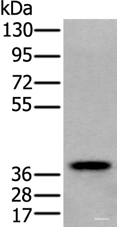 Anti-ZPBP