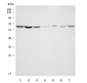 Anti-TKTL1 / Transketolase-like protein 1 / TKR