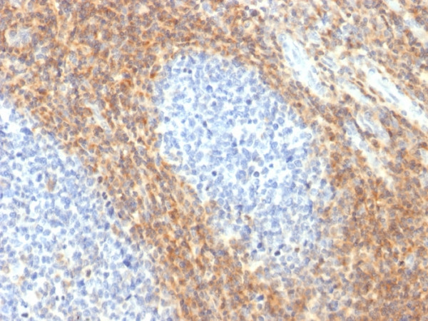 Anti-CD52 (Epididymis-Specific Protein 5), recombinant antibody, clone CD52/2276R