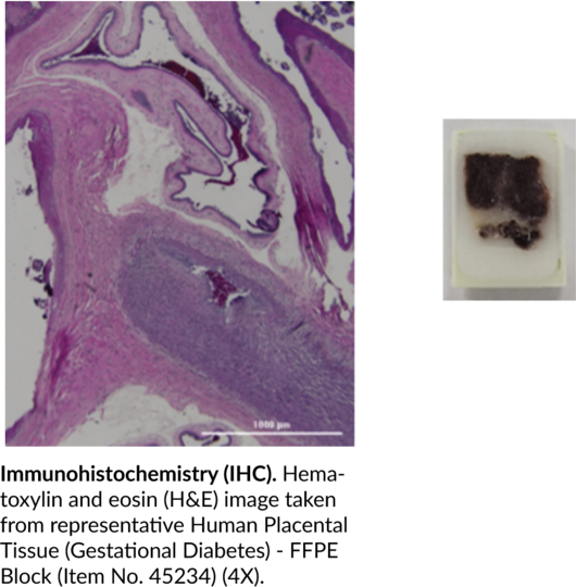 Human Placental Tissue (Gestational Diabetes) - FFPE Block