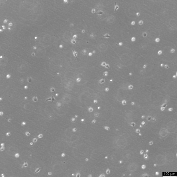 NCI-H146 Cells