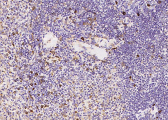 Anti-TNFAIP8 Monoclonal Antibody