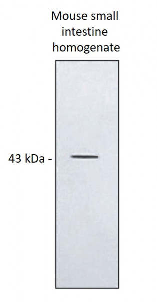 Anti-LTB4R2 / BLT2