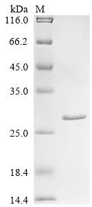 Glutathione S-transferase Mu 1 (Gstm1), partial, mouse, recombinant