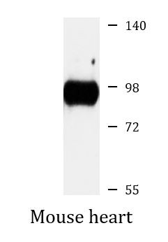 Anti-DVL1 / Dishevelled 1