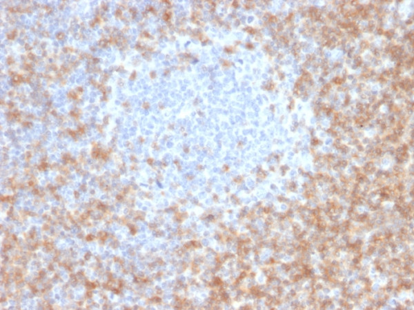 Anti-CD5 (Mantle Cell Lymphoma Marker), clone CD5/2416
