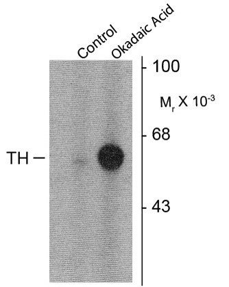 Anti-phospho-Tyrosine Hydroxylase (Ser31)