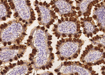 Anti-REG4 Monoclonal Recombinant Antibody