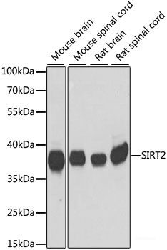 Anti-SIRT2