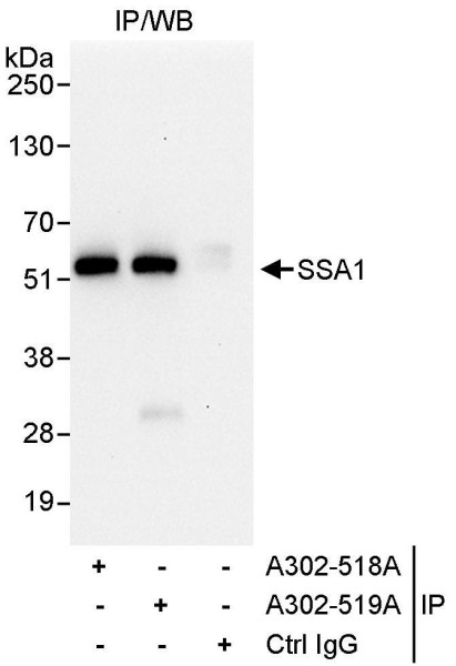 Anti-SSA1