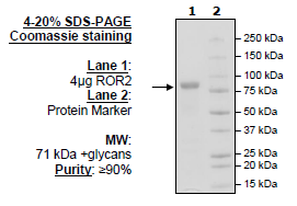 ROR2, Fc-Fusion (IgG1), Avi-Tag, Biotin-Labeled HiP(TM)
