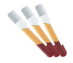 Fresh human plasma from whole human blood in sodium heparin - chilled overnight delivery