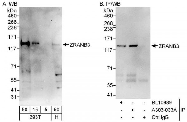 Anti-ZRANB3
