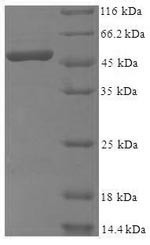 39S ribosomal protein L1, mitochondrial (MRPL1),partial, human, recombinant