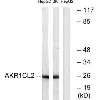 Anti-AKR1E2