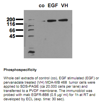 Anti-phospho-EGF-Receptor (Tyr1086), clone 8B8