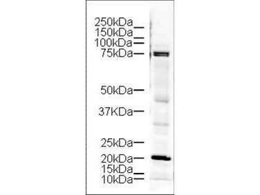 Anti-LIM Kinase