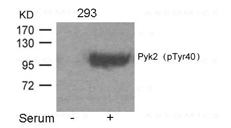 Anti-phospho-Pyk2 (Tyr402)
