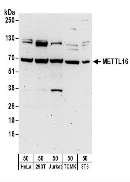Anti-METTL16