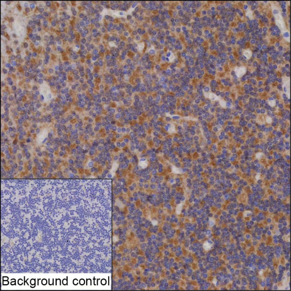 Anti-KCNIP4