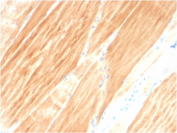 Anti-Sarcomeric Actinin Alpha 2 / ACTN2, clone ACTN2/3295