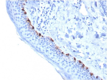 Anti-TRP1 / Tyrosinase-Related Protein-1, clone TYRP1/3284