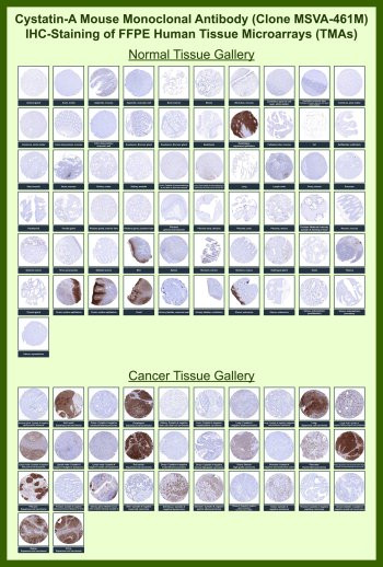 Anti-Cystatin A for IHC / CSTA, clone MSVA-461M