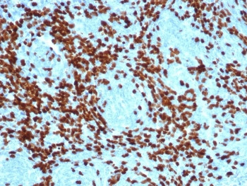 Anti-TdT / DNA nucleotidylexotransferase, clone DNTT/4617R