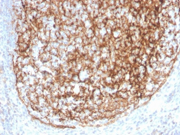 Anti-CD35 / CR1, clone CR1/4382R
