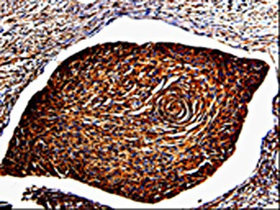Anti-ANXA7