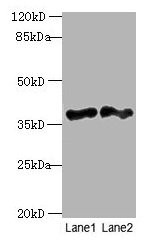 Anti-DNAJB4