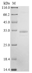 Presenilins-associated rhomboid-like protein, mitochondrial (PARL), human, recombinant