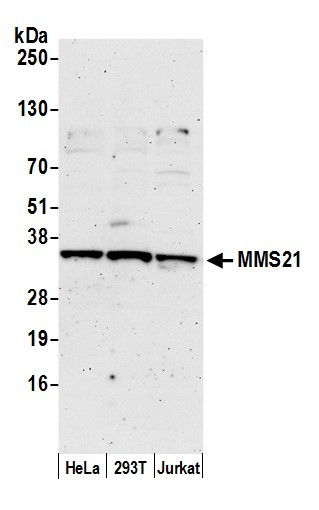 Anti-MMS21