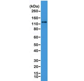 Anti-N-Cadherin / CDH2, clone RM259 (recombinant antibody)