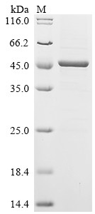 Histone deacetylase 11 (HDAC11), human, recombinant